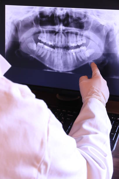 Best Knocked-Out Tooth Emergency  in Oakridge, OR